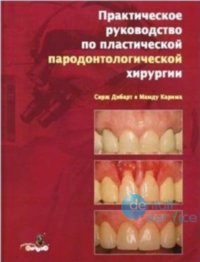 Практическое руководство по пластической пародонтологической хирургии