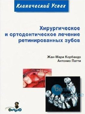 Хирургическое и ортодонтическое лечение ретинированных зубов
