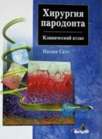 Хирургия пародонта