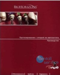 Протезирование с опорой на имплантаты