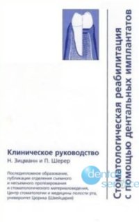 Стоматологическая реабилитация с помощью дентальных имплантатов
