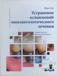 Устранение осложнений имплантологического лечения