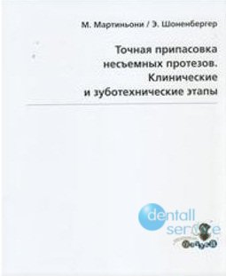 Точная припасовка несъемных протезов. Клинические и зуботехнические этапы