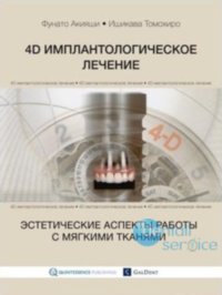 4D имплантологическое лечение: эстетические аспекты работы с мягкими тканями