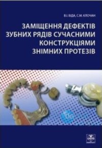 Заміщення дефектів зубних рядів сучасними контсрукціями знімних протезів