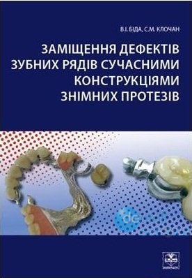 Заміщення дефектів зубних рядів сучасними контсрукціями знімних протезів