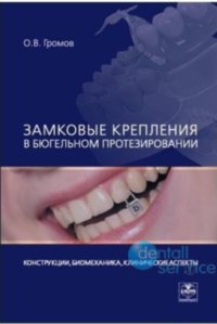 Замковые крепления в бюгельном протезировании