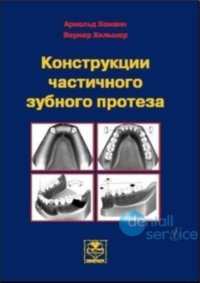 Конструкции частичного зубного протеза