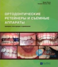 Ортодонтические ретейнеры и съёмные ортодонтические аппараты. Принципы конструкции и применения