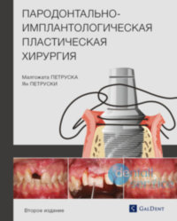 Пародонтально-имплантологическая пластическая хирургия. Второе издание