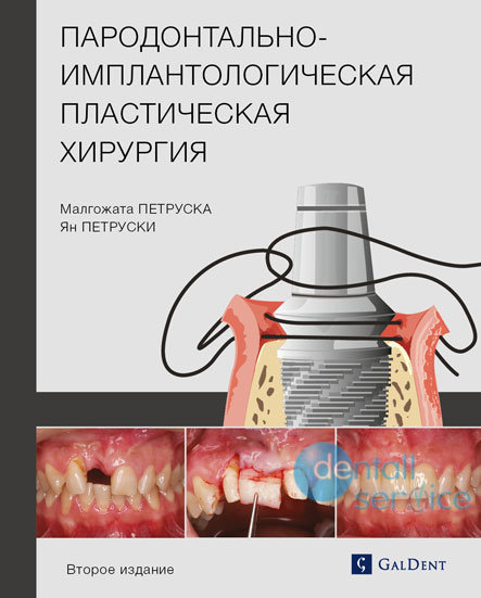 Пародонтально-имплантологическая пластическая хирургия. Второе издание