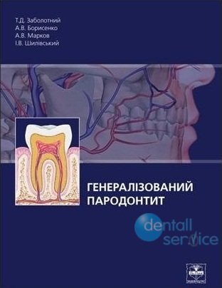 Генерализованный пародонтит