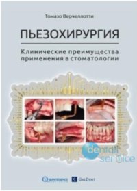 Пьезохирургия. Клинические преимущества применения в стоматологии