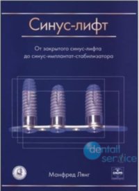 Синус-лифт. От закрытого синус-лифта до синус-имплантат-стабилизатора