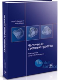 Частичные съёмные протезы