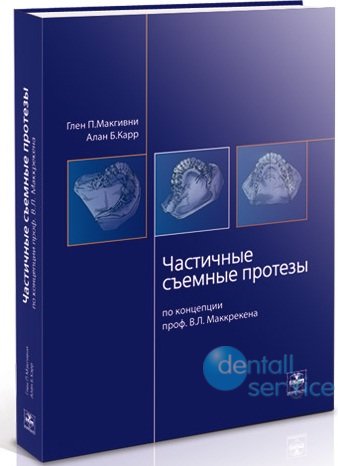 Частичные съёмные протезы