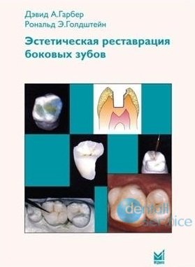 Эстетическая реставрация боковых зубов. Вкладки и накладки