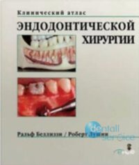 Клинический атлас эндодонтической хирургии